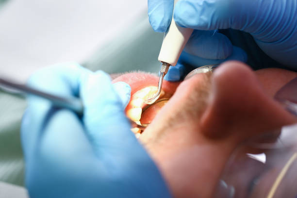 Best Emergency Care for Gum Disease in Murphy, MO
