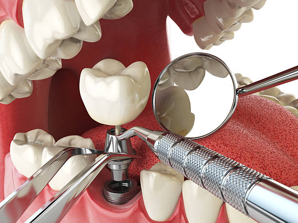 Best Emergency Treatment for Oral Infections in Murphy, MO